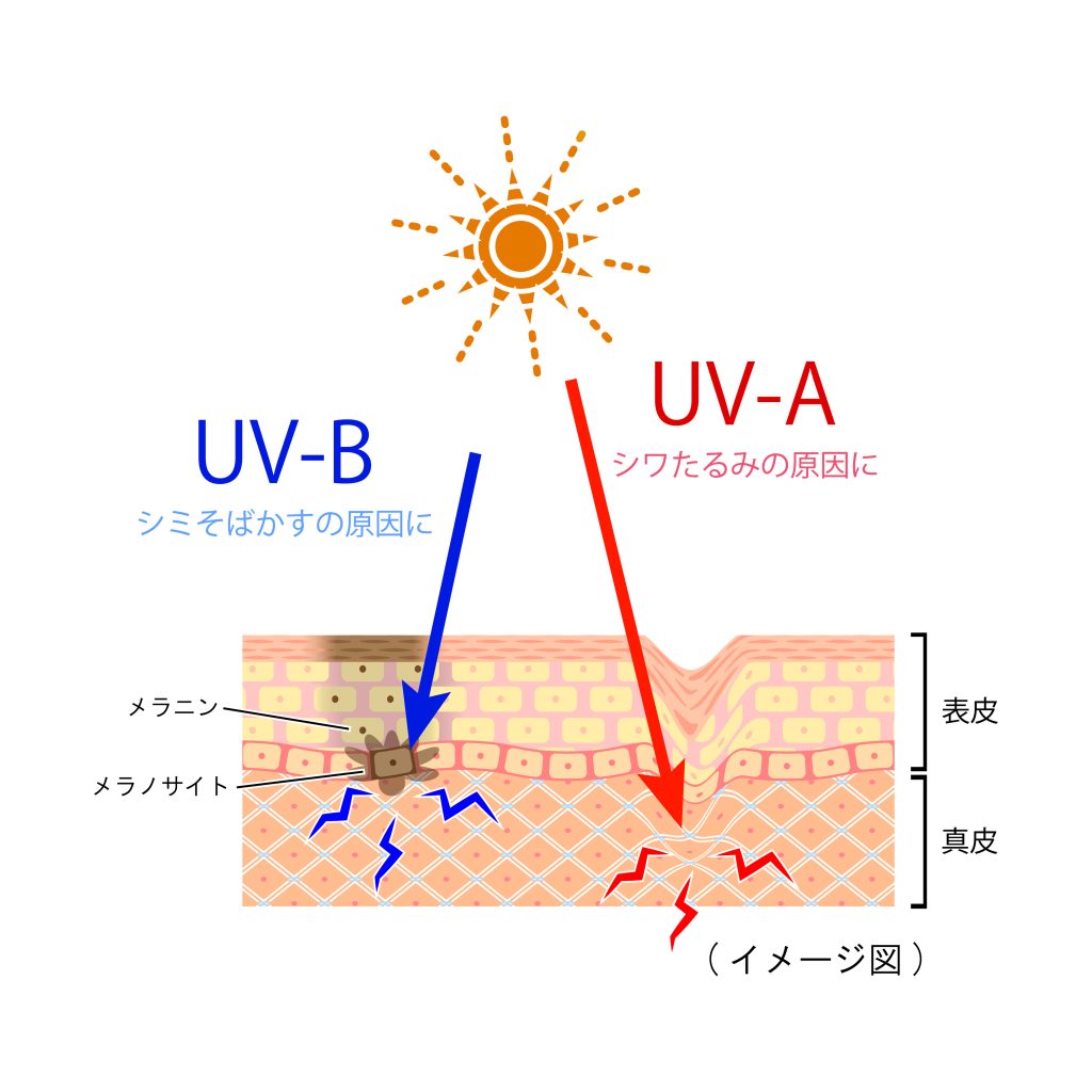 UBAとUVB