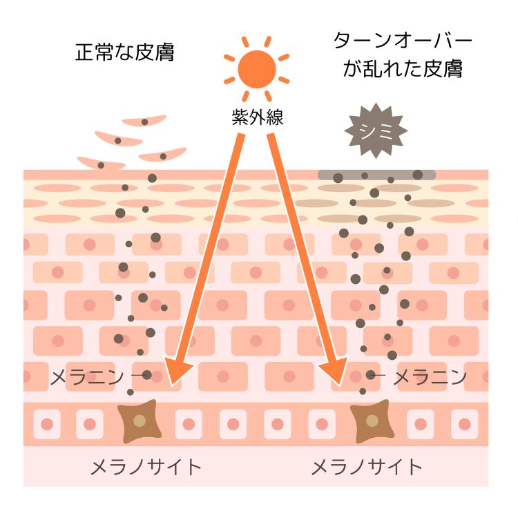 紫外線によってシミができるメカニズム