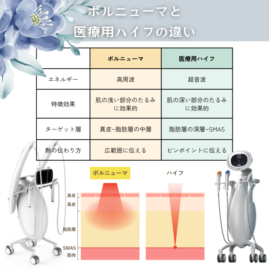 ボルニューマとハイフの違い