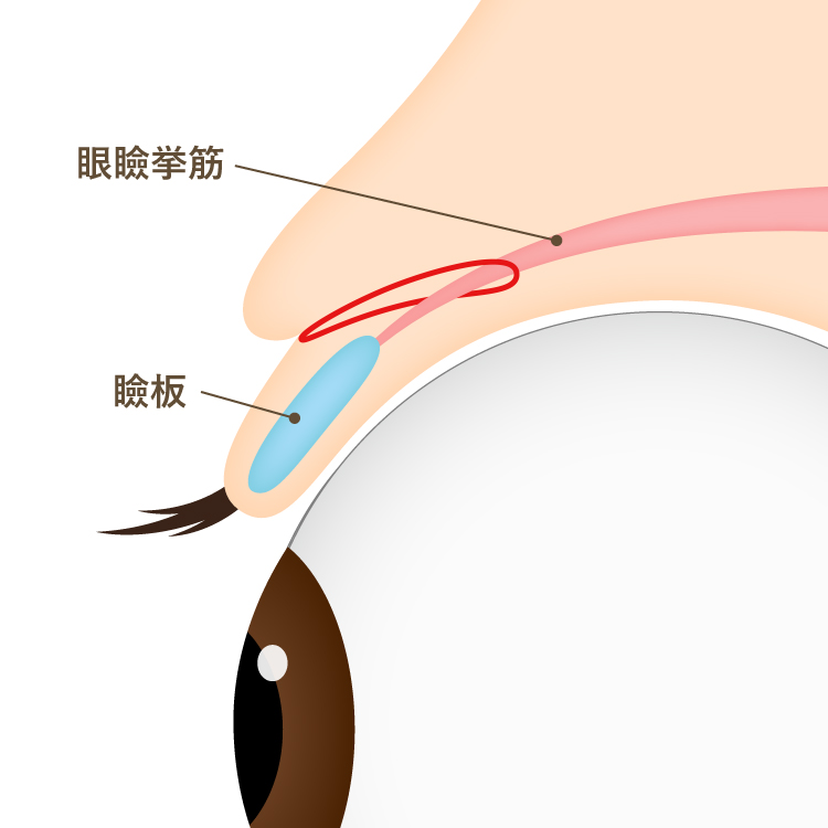 挙筋法