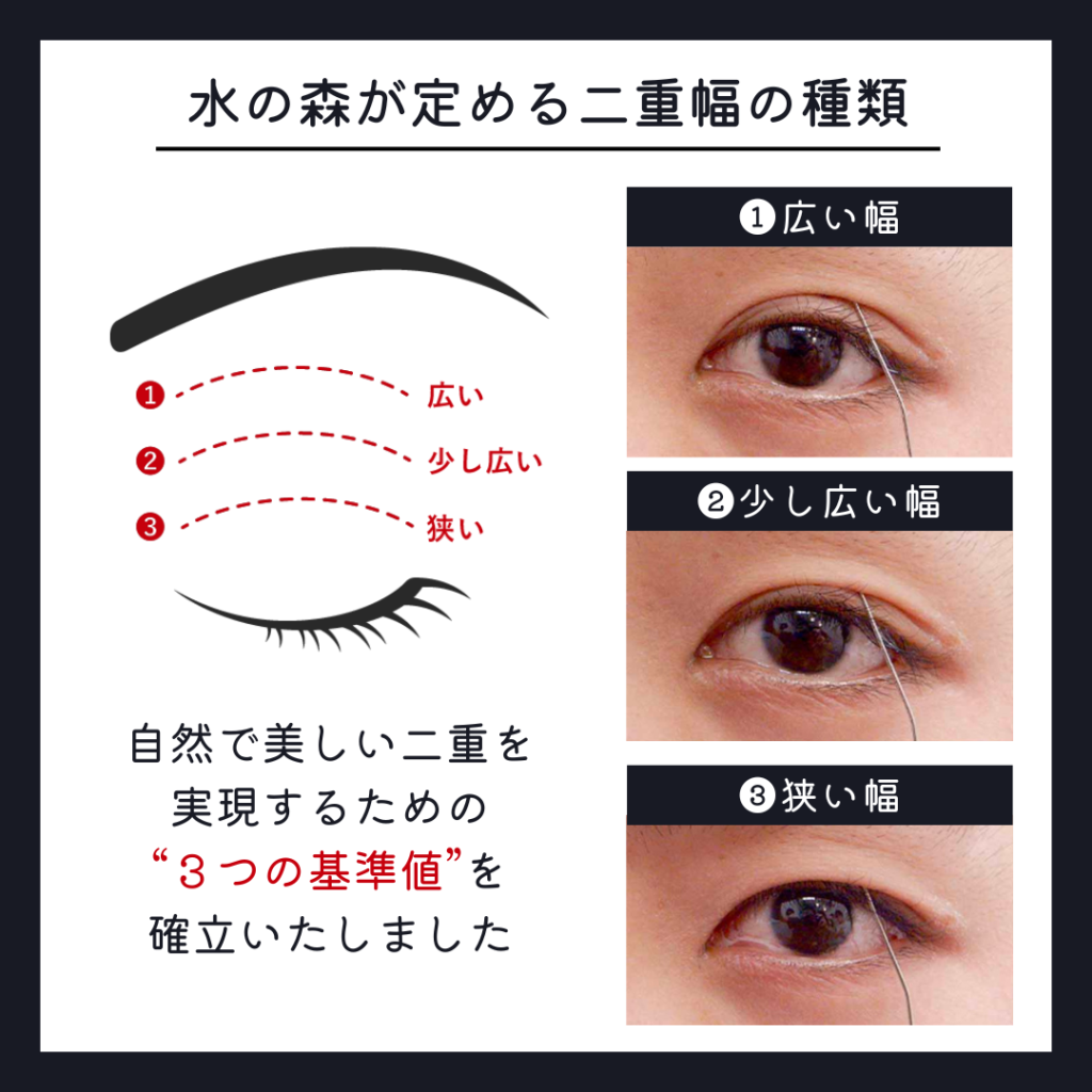 水の森の定める二重幅の種類