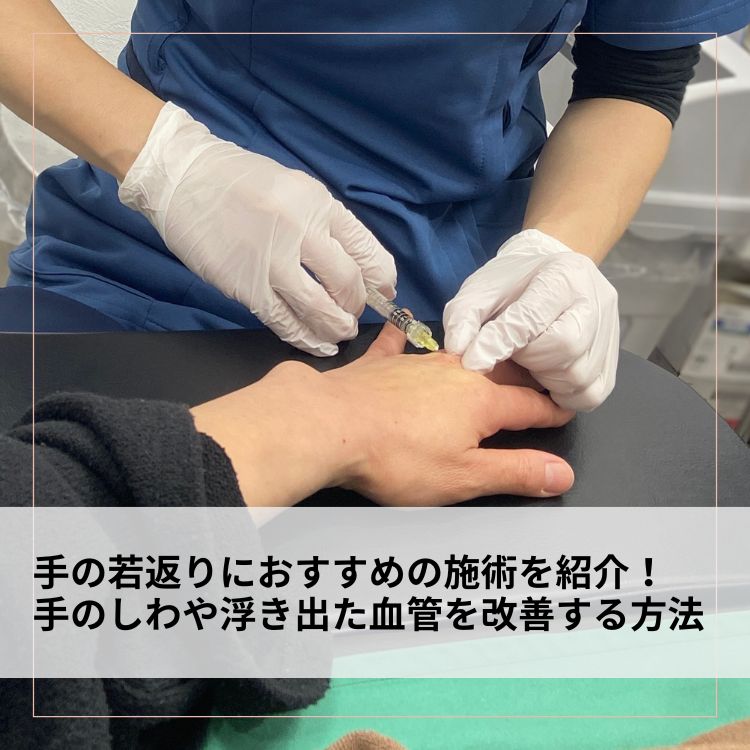 手の若返りにおすすめの施術を紹介！手のしわや浮き出た血管を改善する方法