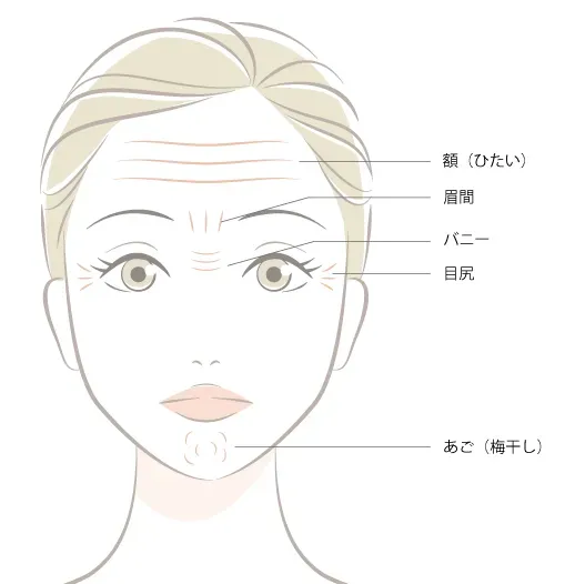 しわ改善の施術部位