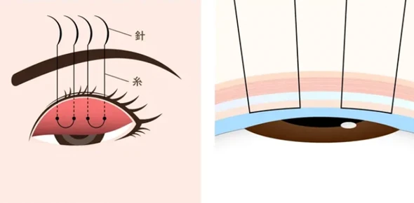 痛みが不安な方へ