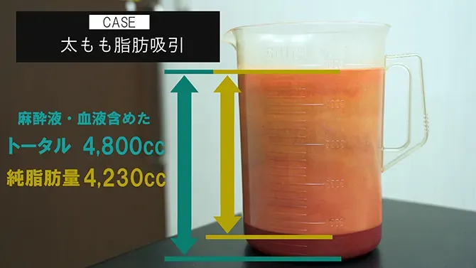 吸引量へのこだわり