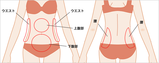 診療項目脂肪吸引 痩身 腹部 ウエスト 腰 美容整形 美容外科なら水の森美容外科 公式 総合サイト