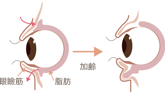 二重まぶた 目もとの整形なら水の森美容外科 公式
