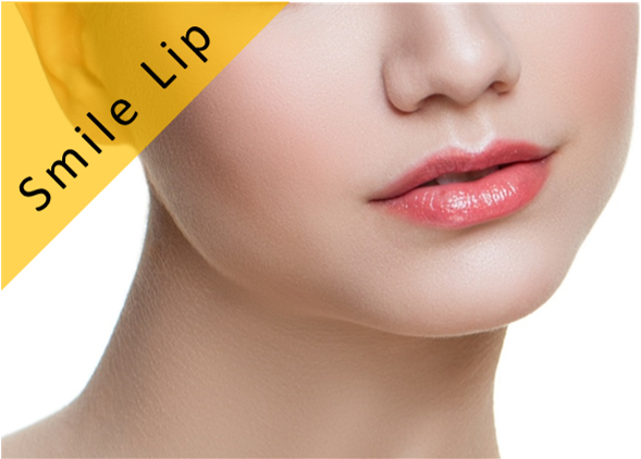 唇のヒアルロン酸注入 注入認定医が在籍 美容整形 美容外科なら水の森美容外科 公式 総合サイト