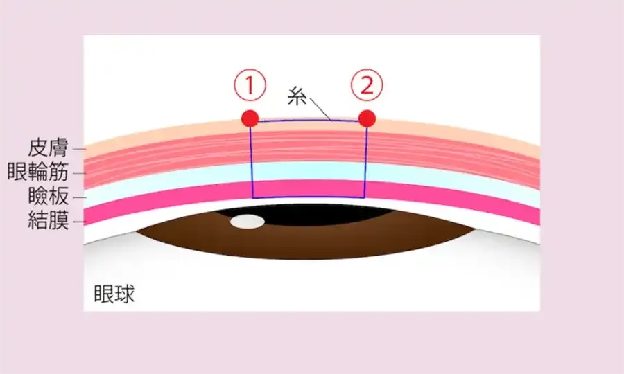 1本の糸でも糸が通る穴が2つある2点留め