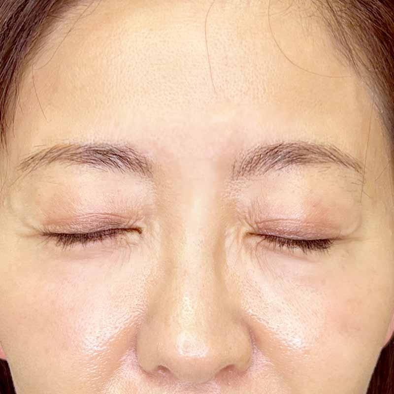 20230702_artmake_eyebrow_W_part 追加写真2回目術後2ヶ月目