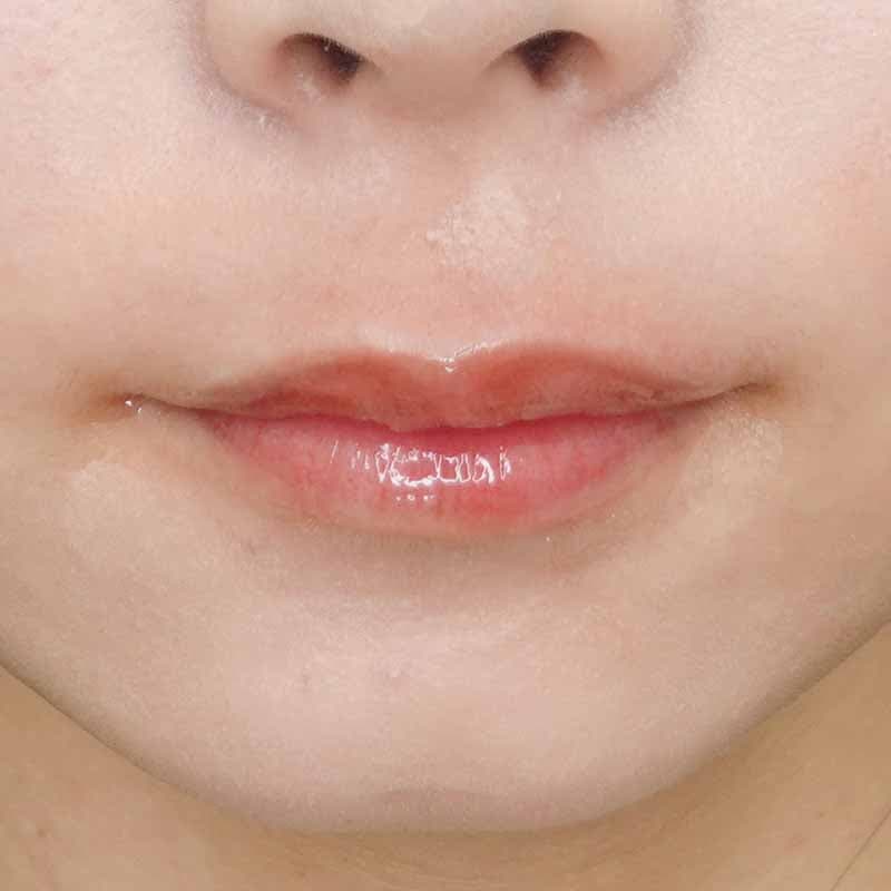 20231008_S1008_artmake_lips 追加写真1回目施術後